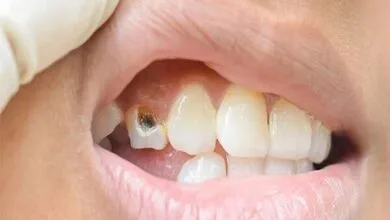 مسئولیت آموزش و پرورش در قبال سلامت دندان دانشآموزان چیست؟ مسئولیت آموزش و پرورش در قبال سلامت دندان دانشآموزان چیست؟