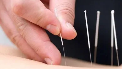 طب سوزنی، فواید و عوارض طب سوزنی، فواید و عوارض
