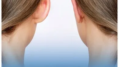 عمل زیبایی گوش یا اتوپلاستی عمل زیبایی گوش یا اتوپلاستی