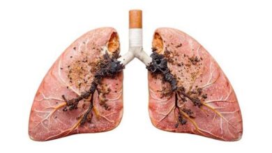 سیگار قاتل ریهها است؛ آمار رو به افزایش سرطان ریه در زنان سیگار قاتل ریهها است؛ آمار رو به افزایش سرطان ریه در زنان