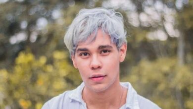 آیا سفید شدن یکشبه موها واقعیت دارد؟ آیا سفید شدن یکشبه موها واقعیت دارد؟