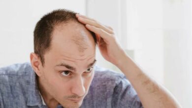 ۵ دلیل تداوم ریزش موهای سر