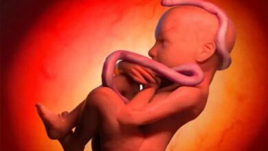 یافته جدید محققان درباره سلامت مادر باردار و ابتلا به اوتیسم نوزاد یافته جدید محققان درباره سلامت مادر باردار و ابتلا به اوتیسم نوزاد