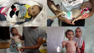 شهادت یک نوزاد فلسطینی و مرگ تدریجی نوزادی دیگر در غزه+ تصاویر