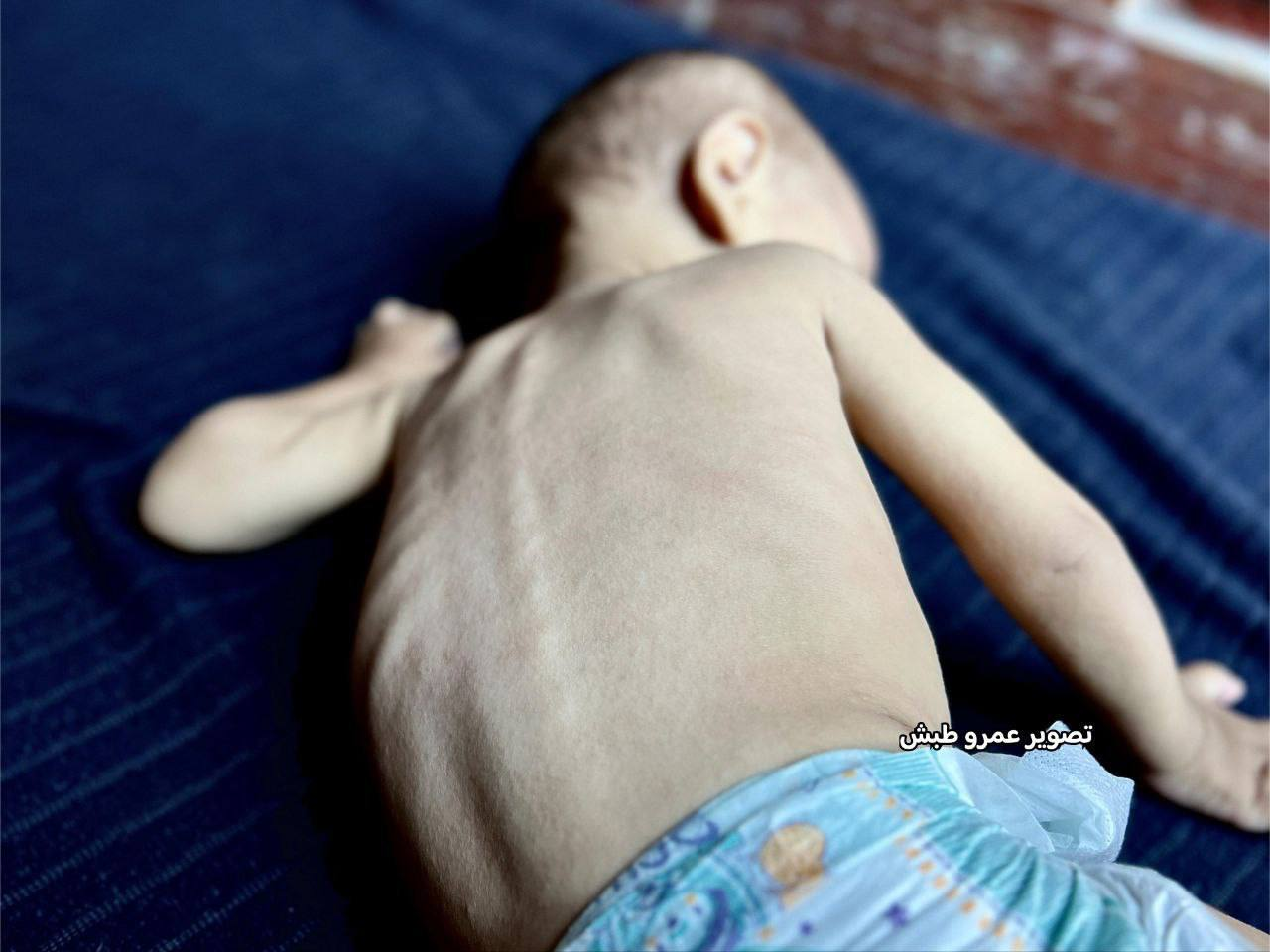 شهادت یک نوزاد فلسطینی و مرگ تدریجی نوزادی دیگر در غزه+ تصاویر