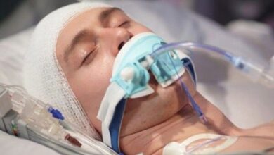 تهدید خاموش سرمایه انسانی؛ ضربه مغزی زندگی را متوقف می‌کند