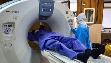 جهش ایران در تولید رادیودارو؛ افزایش اسکنرهای پزشکی هسته‌ای در ۳۱استان