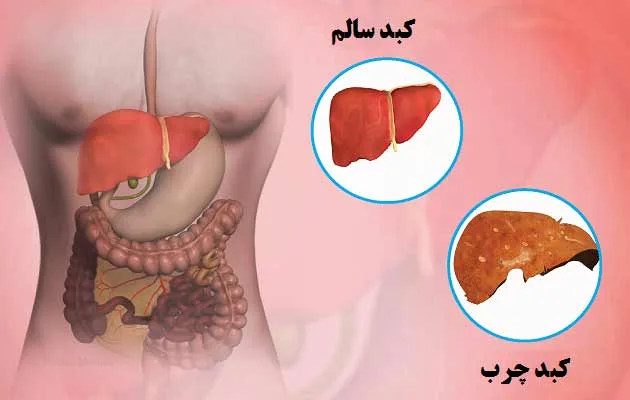 کبد سالم با رژیم گیاهی: از سلامت بدن تا همدلی با حیوانات کبد سالم با رژیم گیاهی: از سلامت بدن تا همدلی با حیوانات