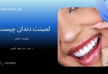 لمینت دندان لمینت دندان