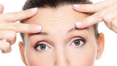 لیفت شقیقه برای چه نوع افتادگی پوستی مناسب است؟